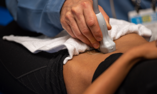 First trimester screening in general practice